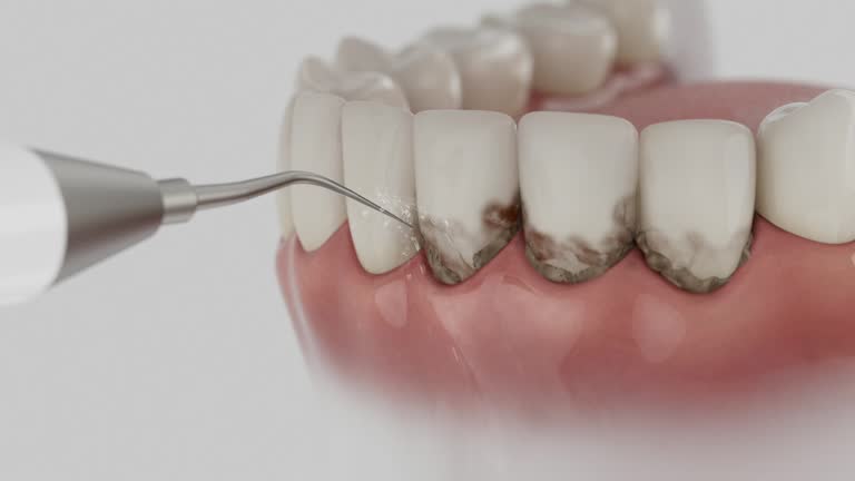 Trusted Dental Crowns And Bridges service in Franklin, LA - Dentist Open Now